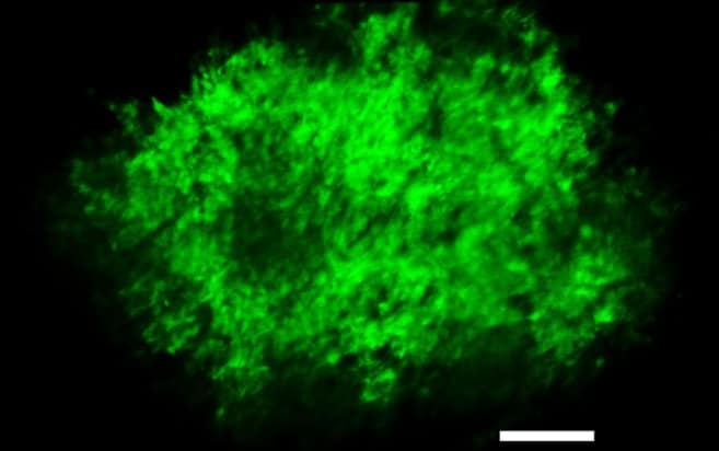 Fluorescence mapping