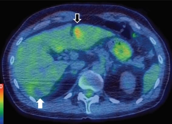 PET/CT image