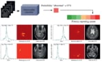 Automated head MRI triage