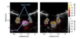 Photoacoustic images of the ulnar and median nerves from a pig