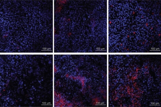 Immune cell infiltration