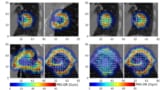 FLASH scan patterns