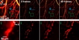 Optical-resolution photoacoustic microscopy