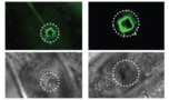 3D printing in a living organism