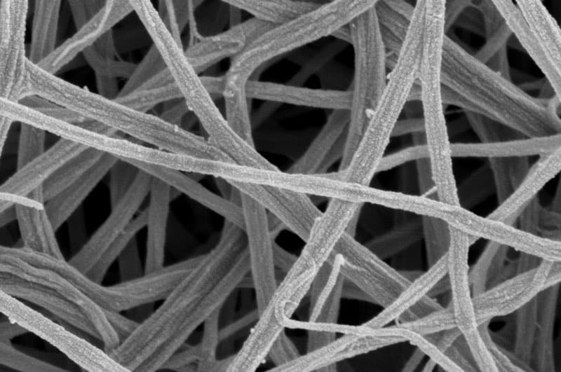 Confocal fluorescent microscope image of a network of filaments