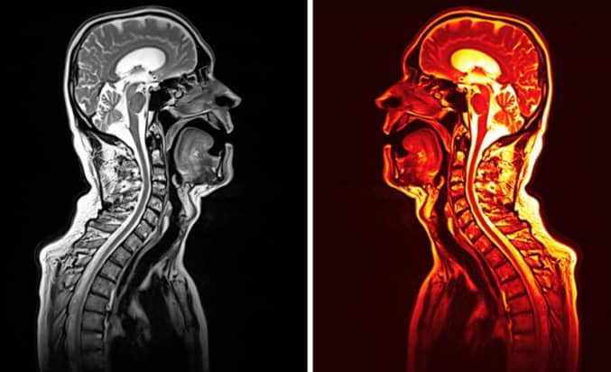 Mirror images of two 3T MRI scans