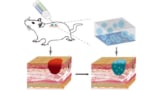 A wound-healing ink can be 3D printed directly into injuries